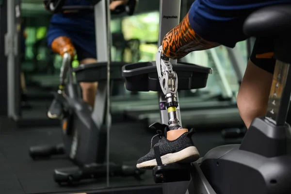 depositphotos_657030158-stock-photo-disabled-athlete-patient-prosthetic-leg